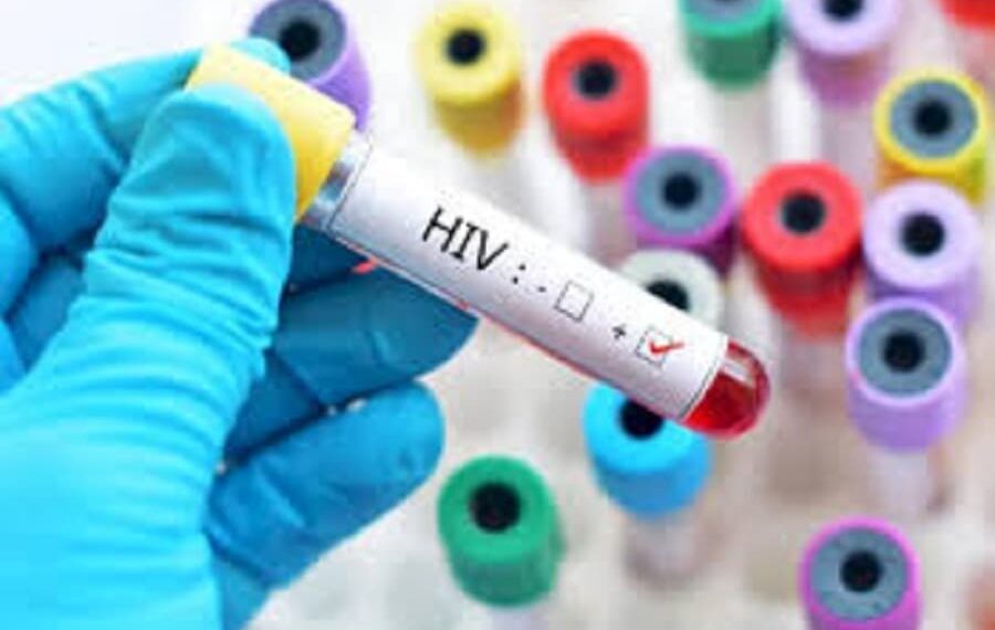 Segundo caso mundial de cura de paciente com HIV é confirmado