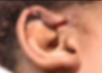 Foto: Reprodução/ TV Gazeta