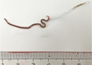 Imagem: Divulgação/The American Society of Tropical Medicine and Hygiene