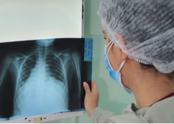 Foto: Divulgação/SES-AM