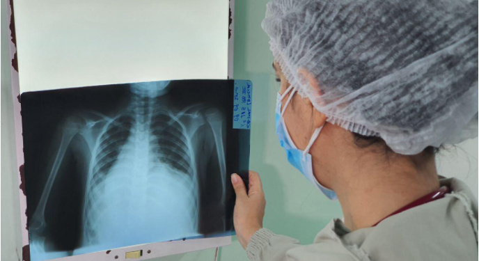 Foto: Divulgação/SES-AM