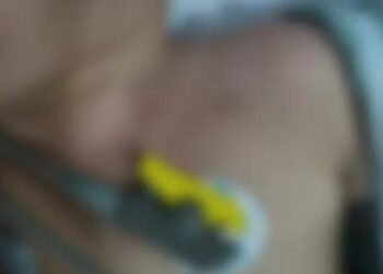 Foto; Reprodução/ G1