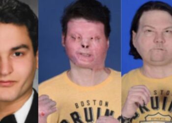 Foto: Reprodução/ NYU Langone Health