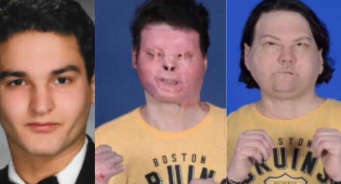 Foto: Reprodução/ NYU Langone Health