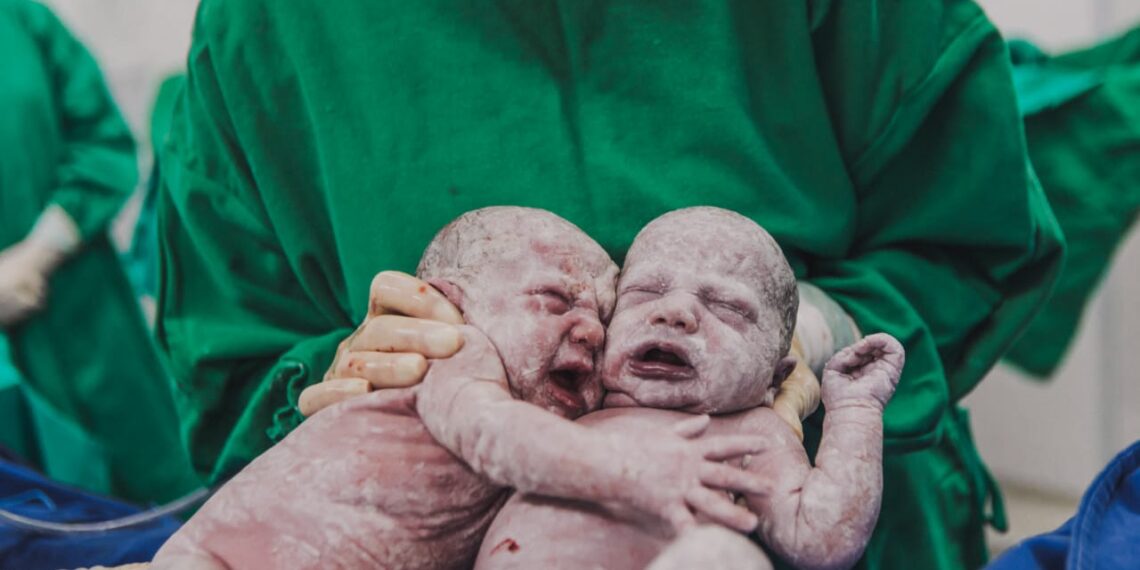 Emocionante! Gêmeas se abraçam após nascimento e foto encanta internautas