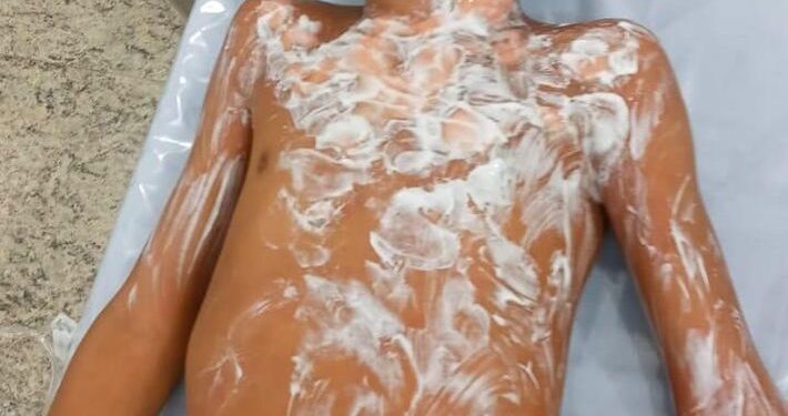 Foto: Reprodução/ O Correio News