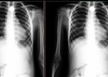 Foto: Arquivo pessoal