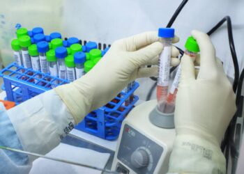 Paraná mantém liderança nacional na detecção da Covid-19 - Esse resultado só foi alcançado em função da parceria com a Unidade de Apoio ao Diagnóstico da Covid-19, implantada pelo Instituto de Biologia Molecular do Paraná (IBMP) em abril de 2020, em parceria com a Fundação Oswaldo Cruz (Fiocruz) do Rio de Janeiro e o Instituto de Tecnologia do Paraná (Tecpar). O laboratório ultrapassou nesta semana a marca de 2 milhões de testes RT-PCR. Esta foi a primeira central de testagem de alto processamento do Brasil e a unidade que mais realizou testes até agora em todo o País. -  Curitiba, 20/05/2021  -  Foto: José Fernando Ogura/AEN