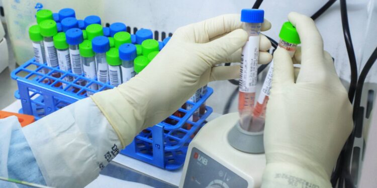 Paraná mantém liderança nacional na detecção da Covid-19 - Esse resultado só foi alcançado em função da parceria com a Unidade de Apoio ao Diagnóstico da Covid-19, implantada pelo Instituto de Biologia Molecular do Paraná (IBMP) em abril de 2020, em parceria com a Fundação Oswaldo Cruz (Fiocruz) do Rio de Janeiro e o Instituto de Tecnologia do Paraná (Tecpar). O laboratório ultrapassou nesta semana a marca de 2 milhões de testes RT-PCR. Esta foi a primeira central de testagem de alto processamento do Brasil e a unidade que mais realizou testes até agora em todo o País. -  Curitiba, 20/05/2021  -  Foto: José Fernando Ogura/AEN