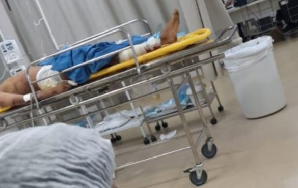 O jovem teve que ser transferido para Manaus por causa da gravidade do ferimento. Foto: Reprodução