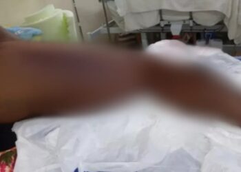 Homem ainda aguarda por leito de hospital especializado. Foto: Divulgação