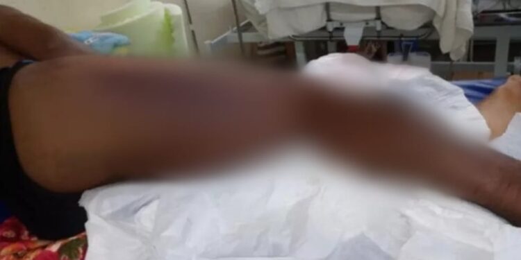 Homem ainda aguarda por leito de hospital especializado. Foto: Divulgação