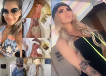 Aline mora sozinha há dois anos, segundo ela, em Florianópolis. Foto: Reprodução: Instagram