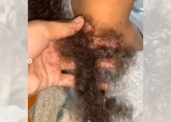 Menina estava dormindo e ao acordar percebeu que o cabelo estava cortado. Foto: Reprodução