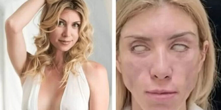 Miss disse que queria apenas corrigir alguns problemas decorrentes da idade. Foto: Divulgação