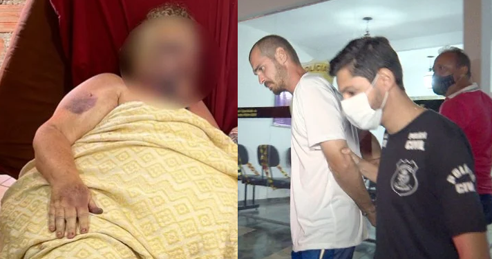 Idosa ficou cinco dias internada, mas não resistiu. Foto: Reprodução