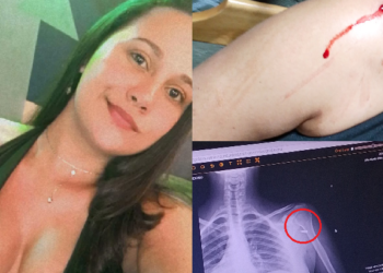 Jovem achou que tinha levado uma pedrada. Foto: Reprodução