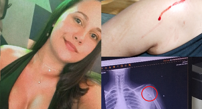 Jovem achou que tinha levado uma pedrada. Foto: Reprodução