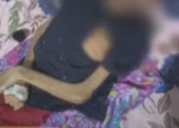 O adolescente foi resgatado em situação lamentável e foi levado ao hospital. Foto: Reprodução