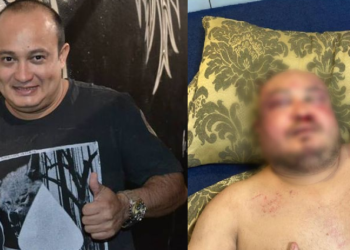 O artista foi brutalmente espancado. Foto: Reprodução