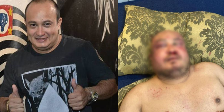 O artista foi brutalmente espancado. Foto: Reprodução