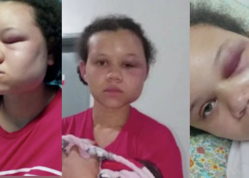 A jovem foi agredida pelo próprio companheiro. Foto: Reprodução