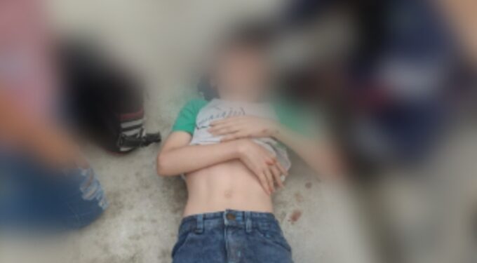 O menino foi socorrido por moradores e o condutor. Foto: Divulgação