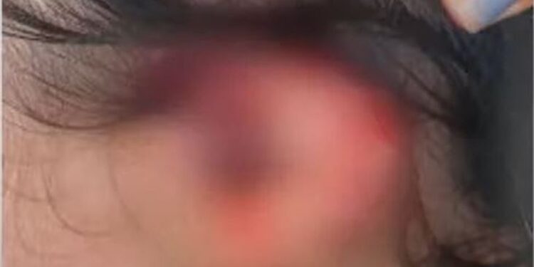 Mulher teve que ser operada em Manaus. Foto: Divulgação