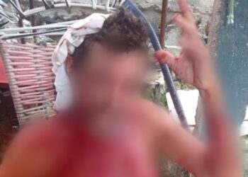 O idoso teve a cabeça machucada e ficou todo ensaguentado. Foto: Reprodução