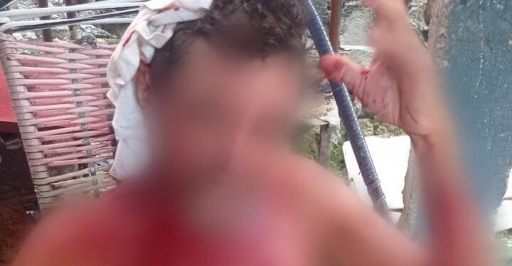 O idoso teve a cabeça machucada e ficou todo ensaguentado. Foto: Reprodução