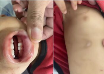 Mulher é investigada por maus-tratos (Foto: Divulgação)