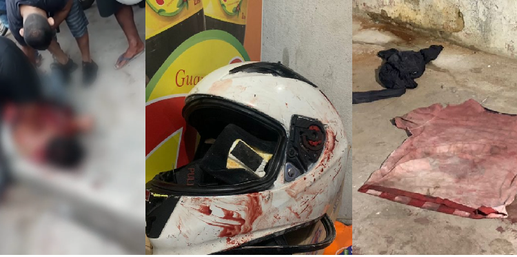 O assaltante foi levado ao hospital pela polícia e depois seria encaminhado ao 19º DIP. Foto: Divulgação