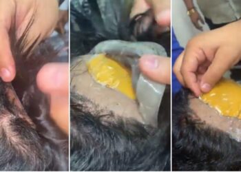 O ouro estava costurada na peruca. Foto: Reprodução