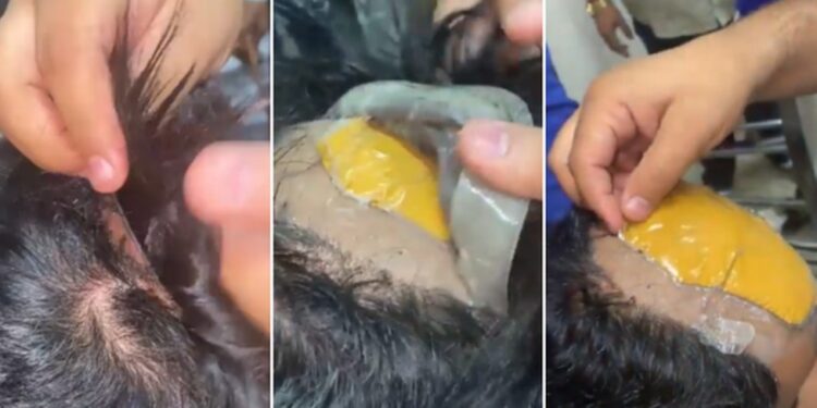 O ouro estava costurada na peruca. Foto: Reprodução