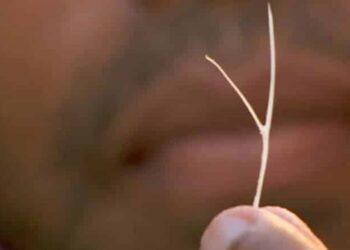 O idoso engoliu a espinha no mês passado e depois sofreu complicações com o passar dos dias. Foto: Reprodução/Internet