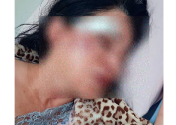 A auxiliar de enfermagem foi agredida com socos e chutes e teve a casa invadida. Foto: Reprodução