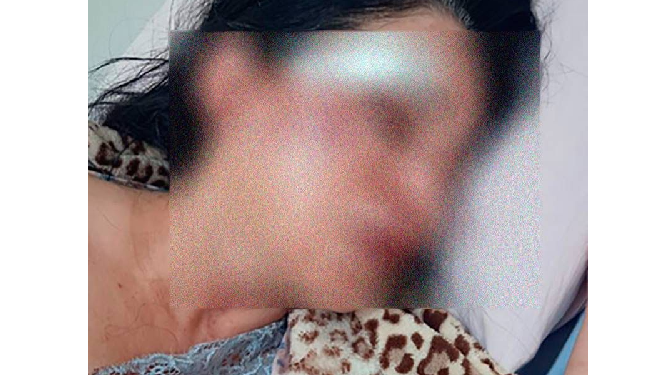 A auxiliar de enfermagem foi agredida com socos e chutes e teve a casa invadida. Foto: Reprodução