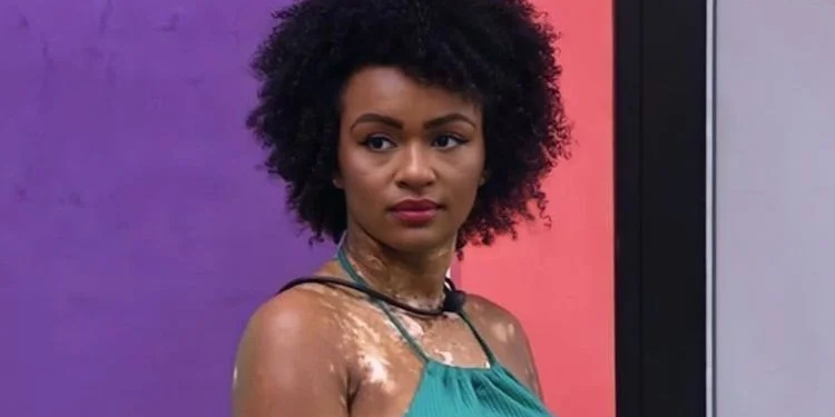 A participante disse que está com alergia. Foto: Reprodução/Internet