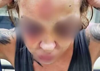 A jornalista chegou a ficar desmaiada. Foto: Reprodução