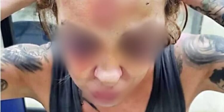 A jornalista chegou a ficar desmaiada. Foto: Reprodução