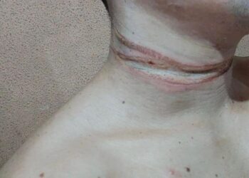 O rapaz, que não teve a identidade revelada, vai entrar com ação na justiça. Foto: Divulgação