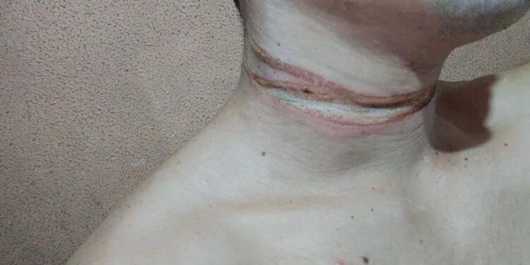 O rapaz, que não teve a identidade revelada, vai entrar com ação na justiça. Foto: Divulgação