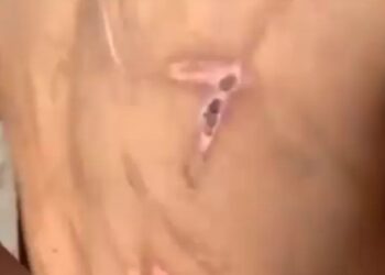 O menino foi resgatado com diversas marcas pelo corpo. Foto: Reprodução