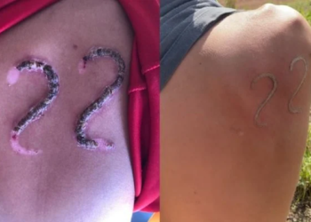 A imagem da 'tatuagem' viralizou nas redes sociais. Foto: Reprodução