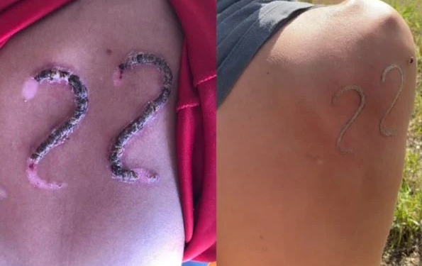 A imagem da 'tatuagem' viralizou nas redes sociais. Foto: Reprodução