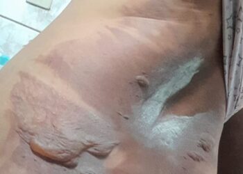 O homem fugiu após o crime. Foto: Reprodução