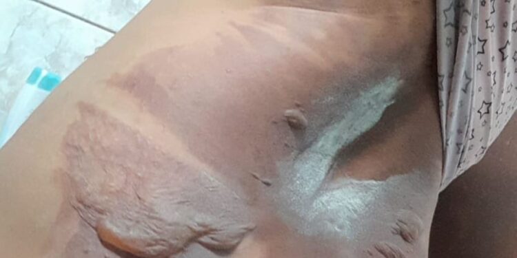 O homem fugiu após o crime. Foto: Reprodução