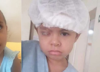 O procedimento será realizado nesta terça-feira (21). Foto: Reprodução