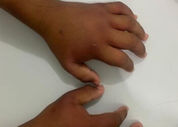 O menino está num abrigo de Manaus. Foto: Reprodução