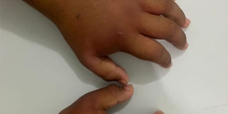 O menino está num abrigo de Manaus. Foto: Reprodução